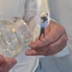 Cupping Acupunctuur Dijkstra